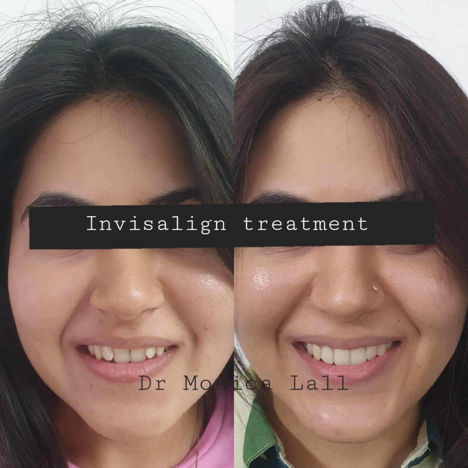 Dental Transformation